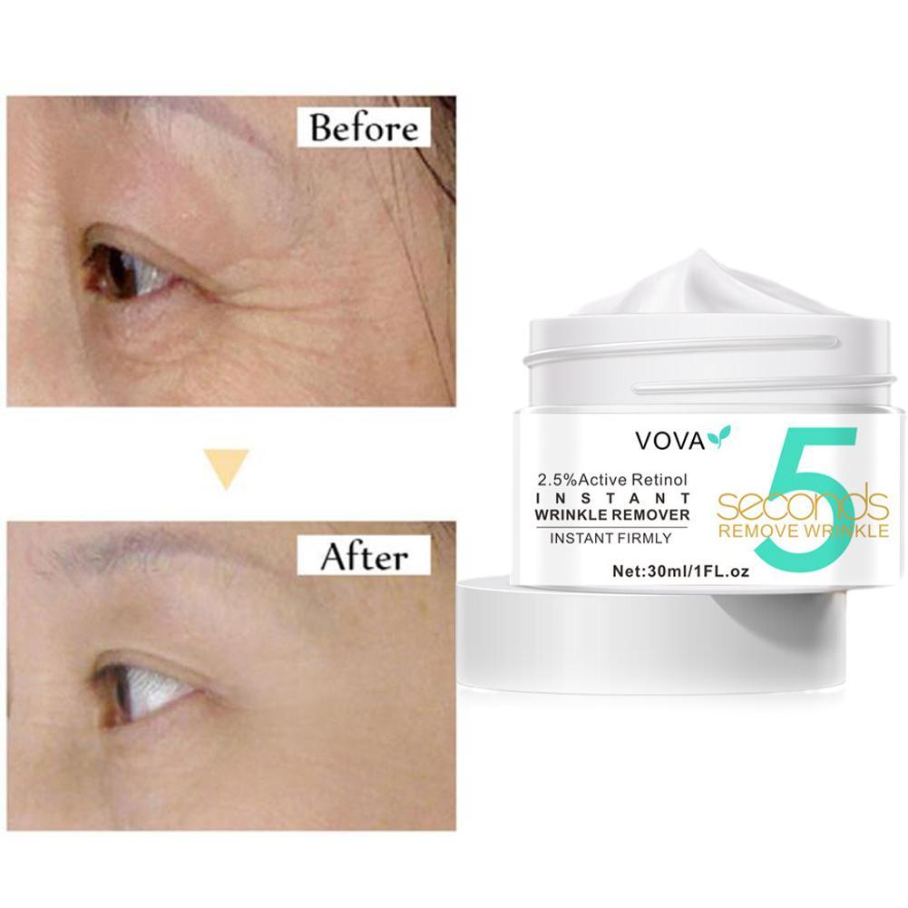 Crème pour les yeux au rétinol - Milk Thistle Silymarin avis et prix
