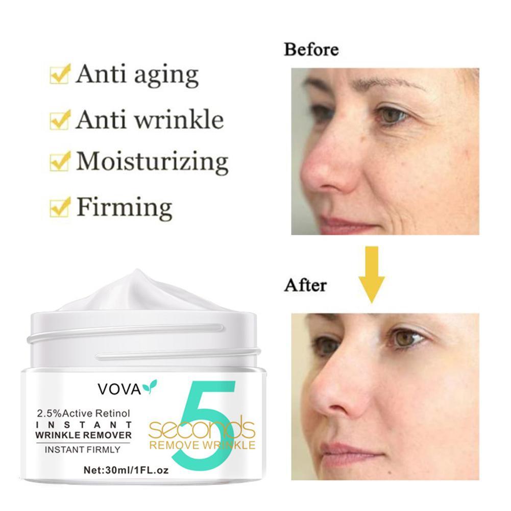 Crème pour les yeux au rétinol - Milk Thistle Silymarin avis et prix