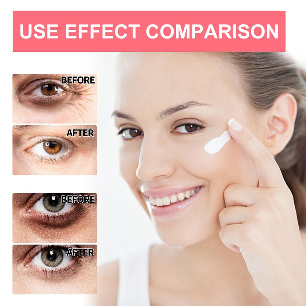 Crème pour les yeux au rétinol - Milk Thistle Silymarin avis et prix