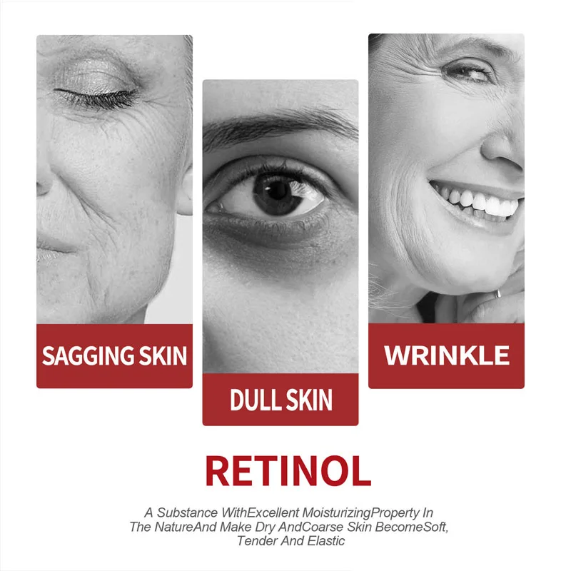 Crème au rétinol soin hydratan - Milk Thistle Silymarin avis et prix
